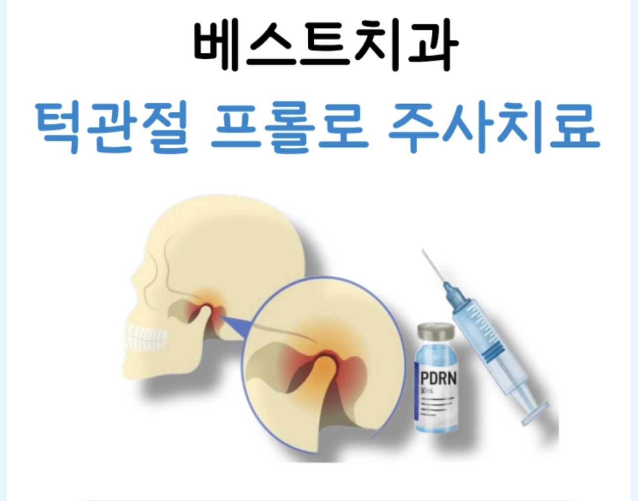 턱관절 프롤로 주사 치료