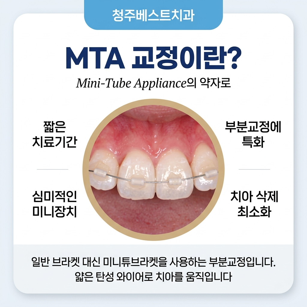 MTA 치아교정